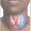 Лечебное питание при заболеваниях щитовидной железы